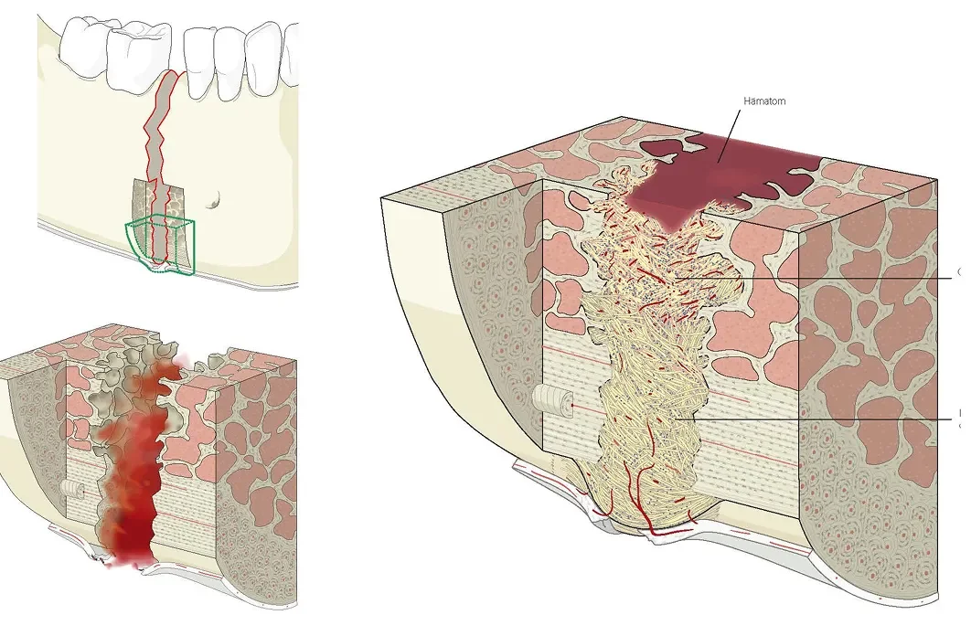 nougat_PF_Med_Ill_05_Page_32 1.webp