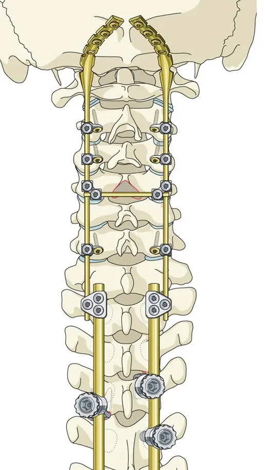 nougat_PF_Med_Ill_05_Page_13 1.webp
