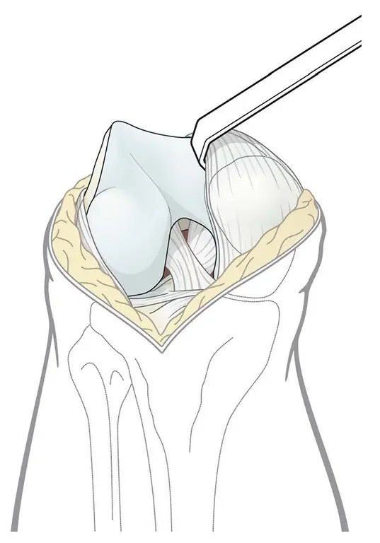 nougat_PF_Med_Ill_05_Page_09 1.webp