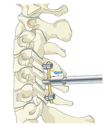 nougat_PF_Med_Ill_05_Page_15 1.webp