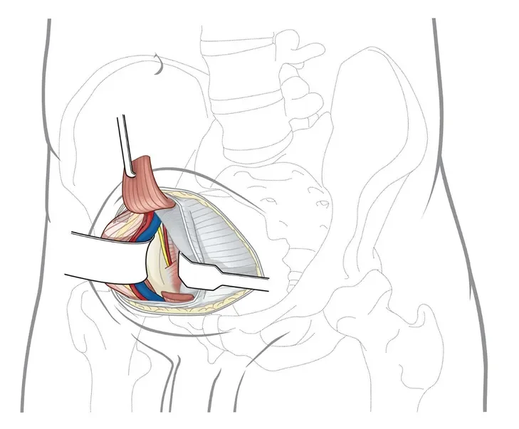 nougat_PF_Med_Ill_05_Page_08 1.webp