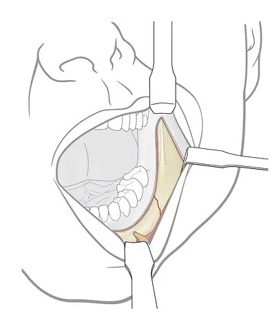 nougat_PF_Med_Ill_05_Page_19 1.webp