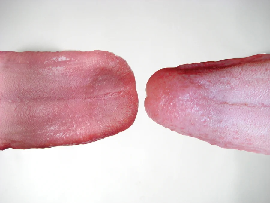 Tongues