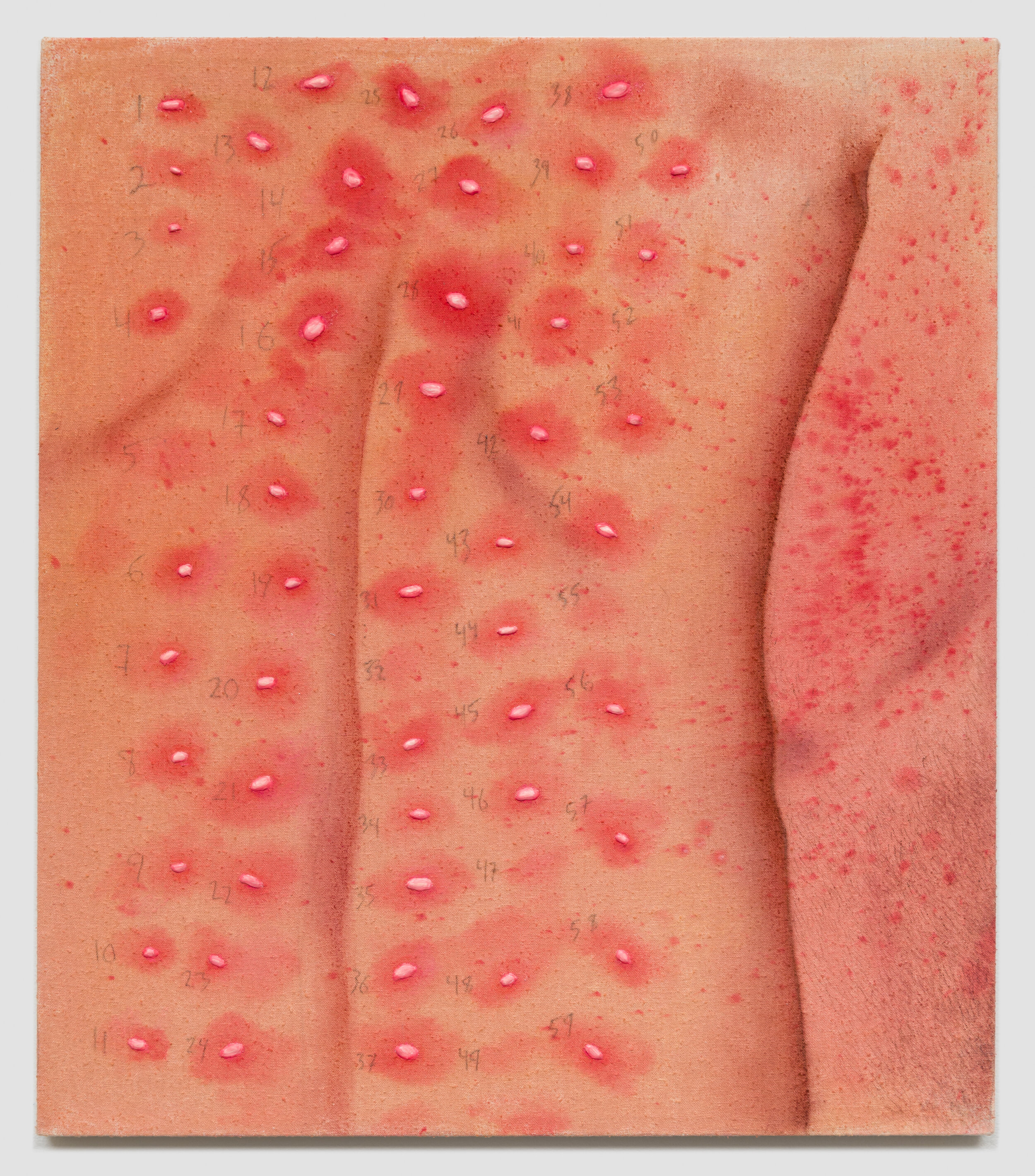 Allergy Test