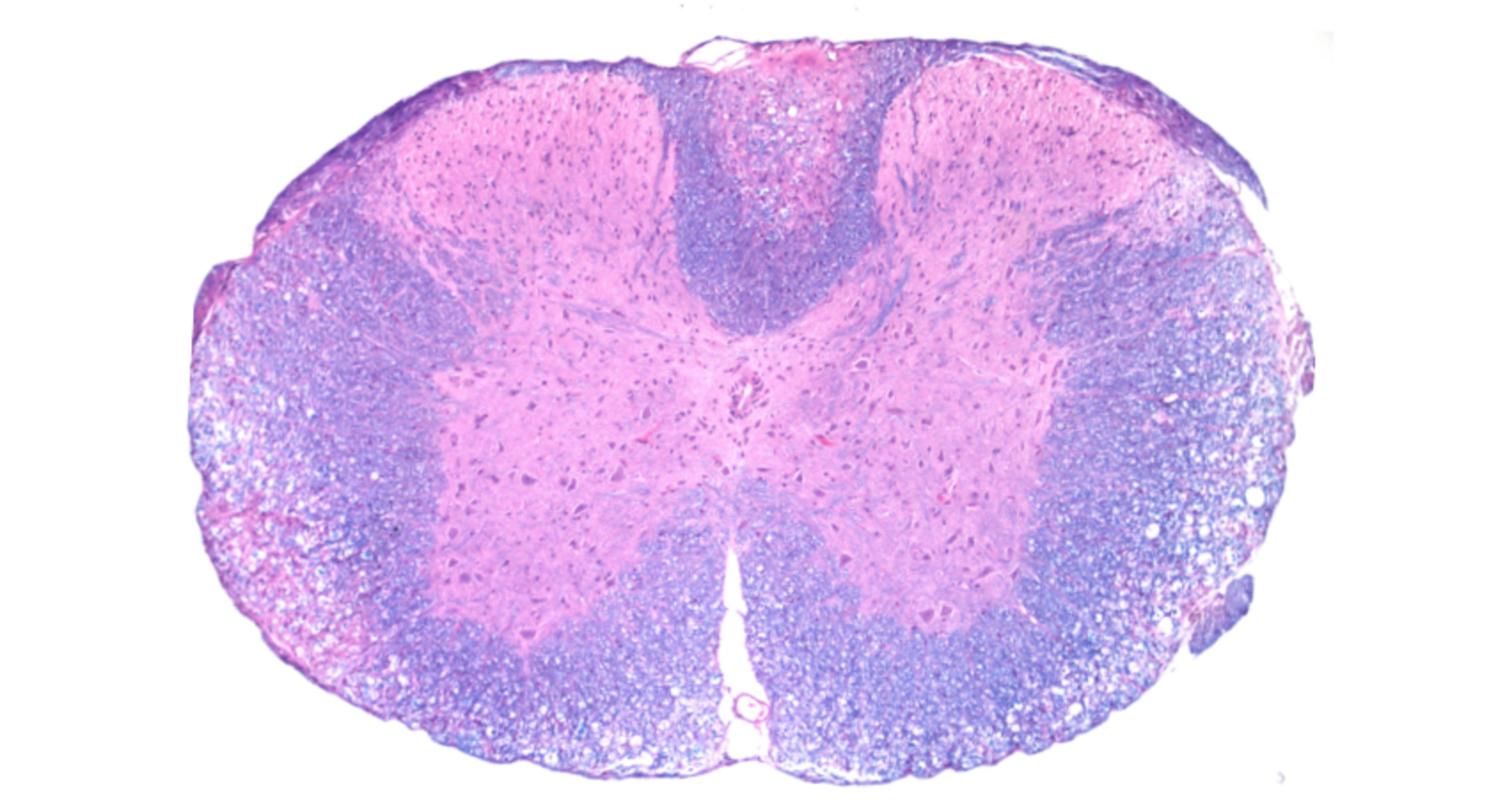 Spinal cord in EAE model with demyelination