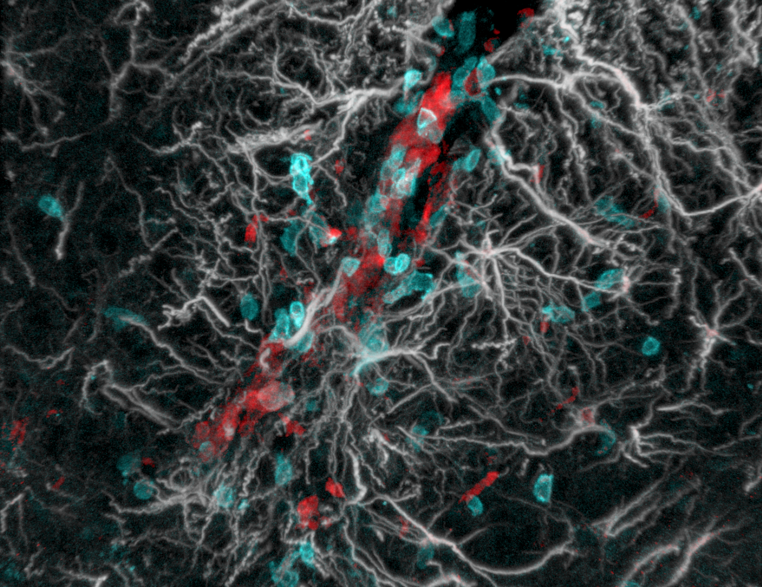 Astrocytes and T cells in EAE spinal cord