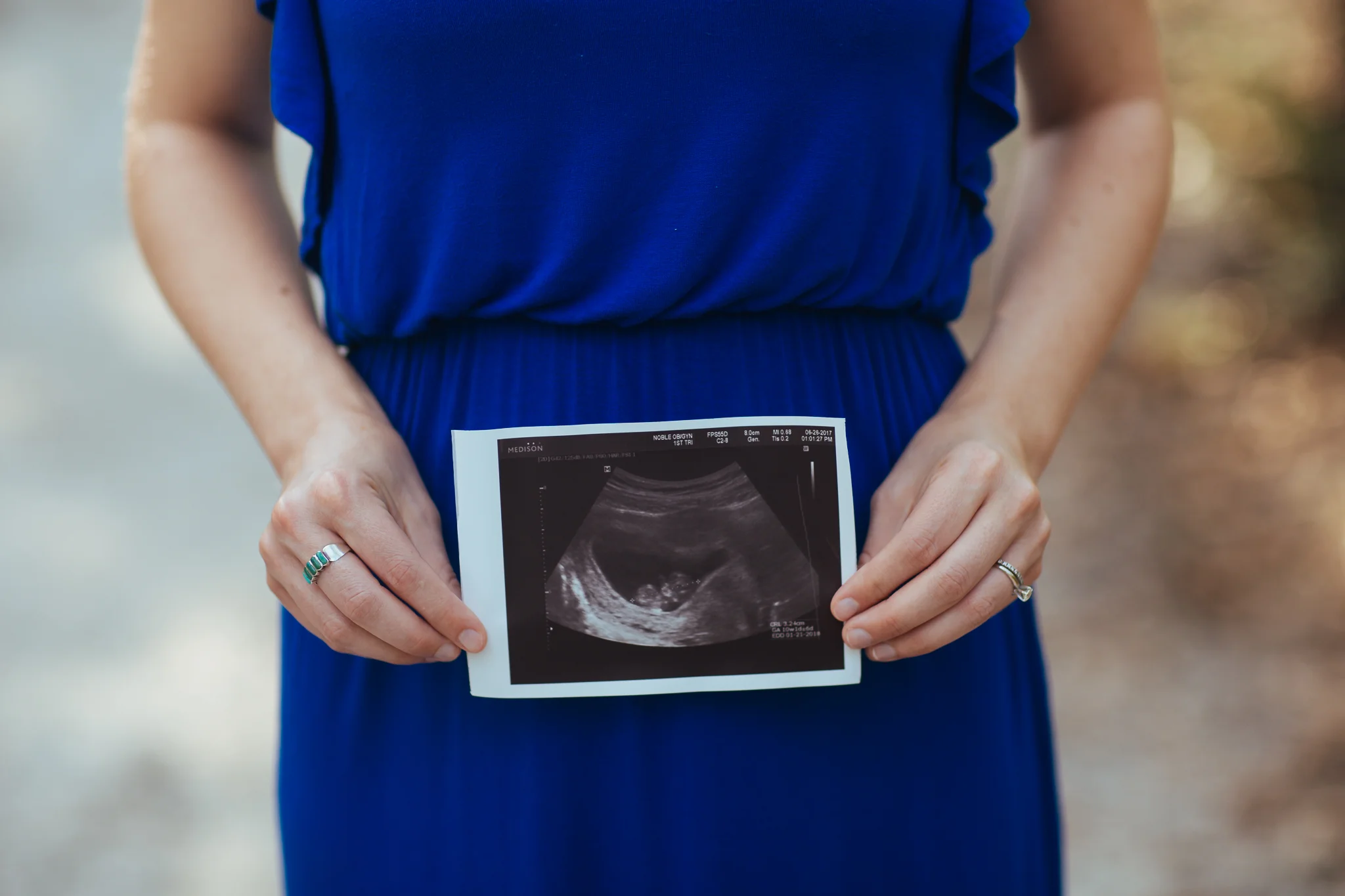 Blog - Maternity - Denton Photographer - Elizalde Photoghaphy-7.jpg