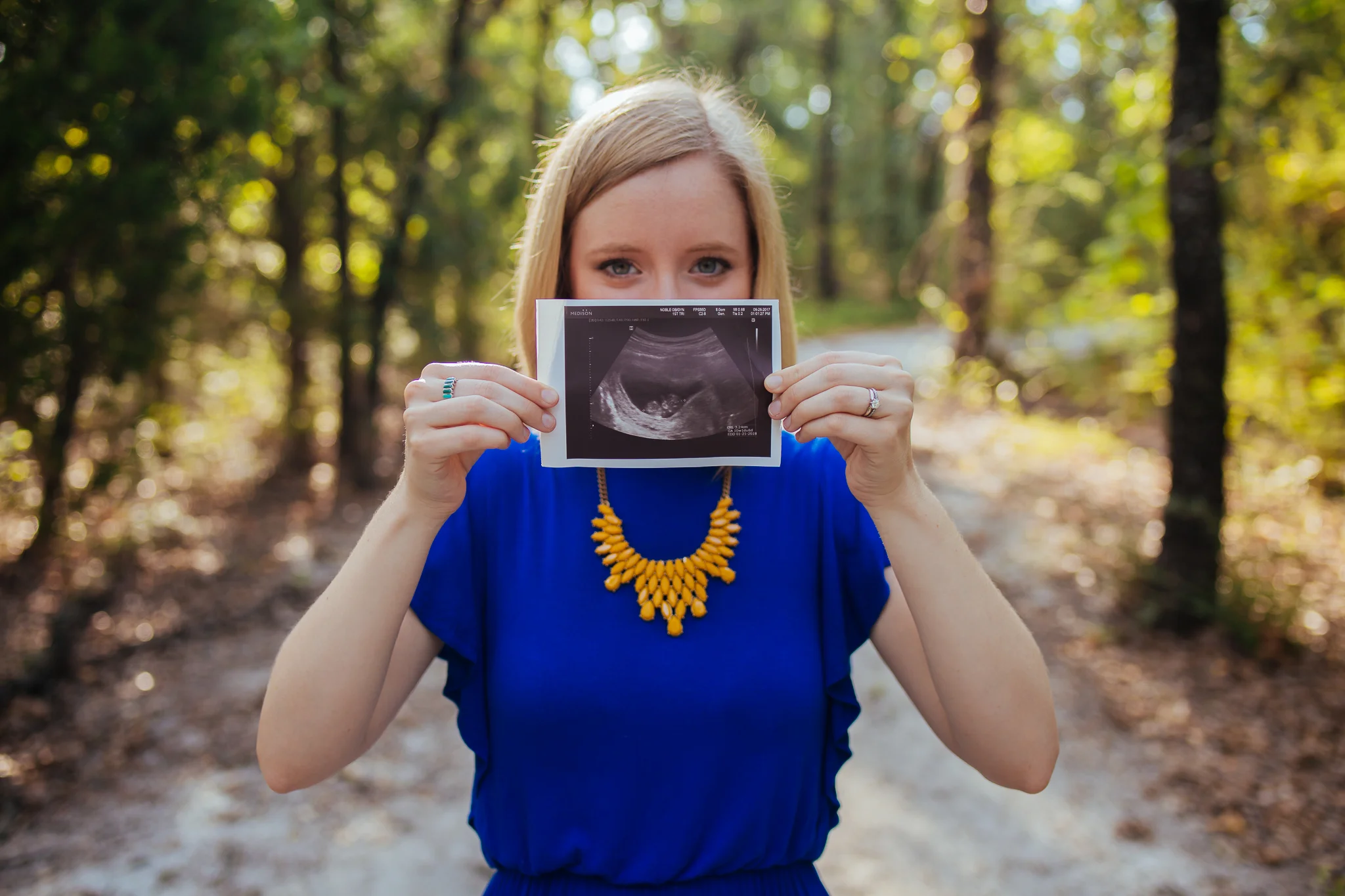 Blog - Maternity - Denton Photographer - Elizalde Photoghaphy-10.jpg