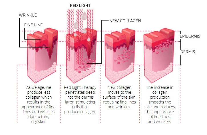 red-led-light-treatment-sonya-dakar.jpg