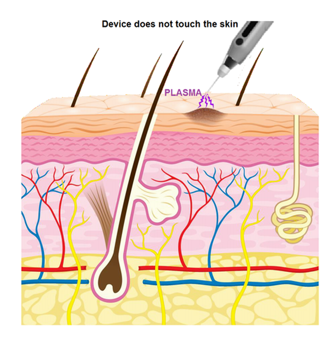 12. Skin Diagram.png