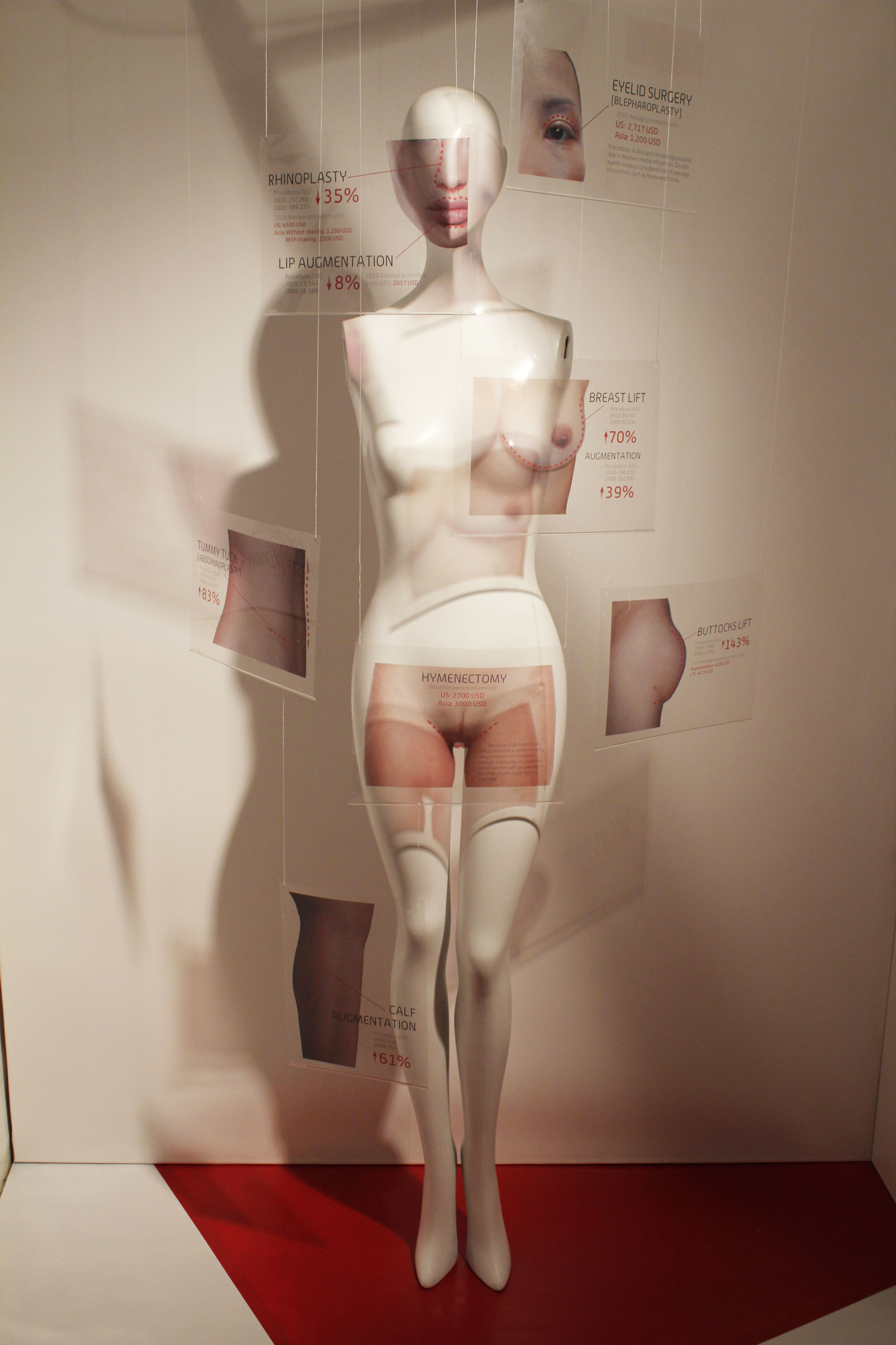  ​Mannequin with factual information about prices, averages, and increases in different surgical procedures from 2000-2010 printed on acetate 