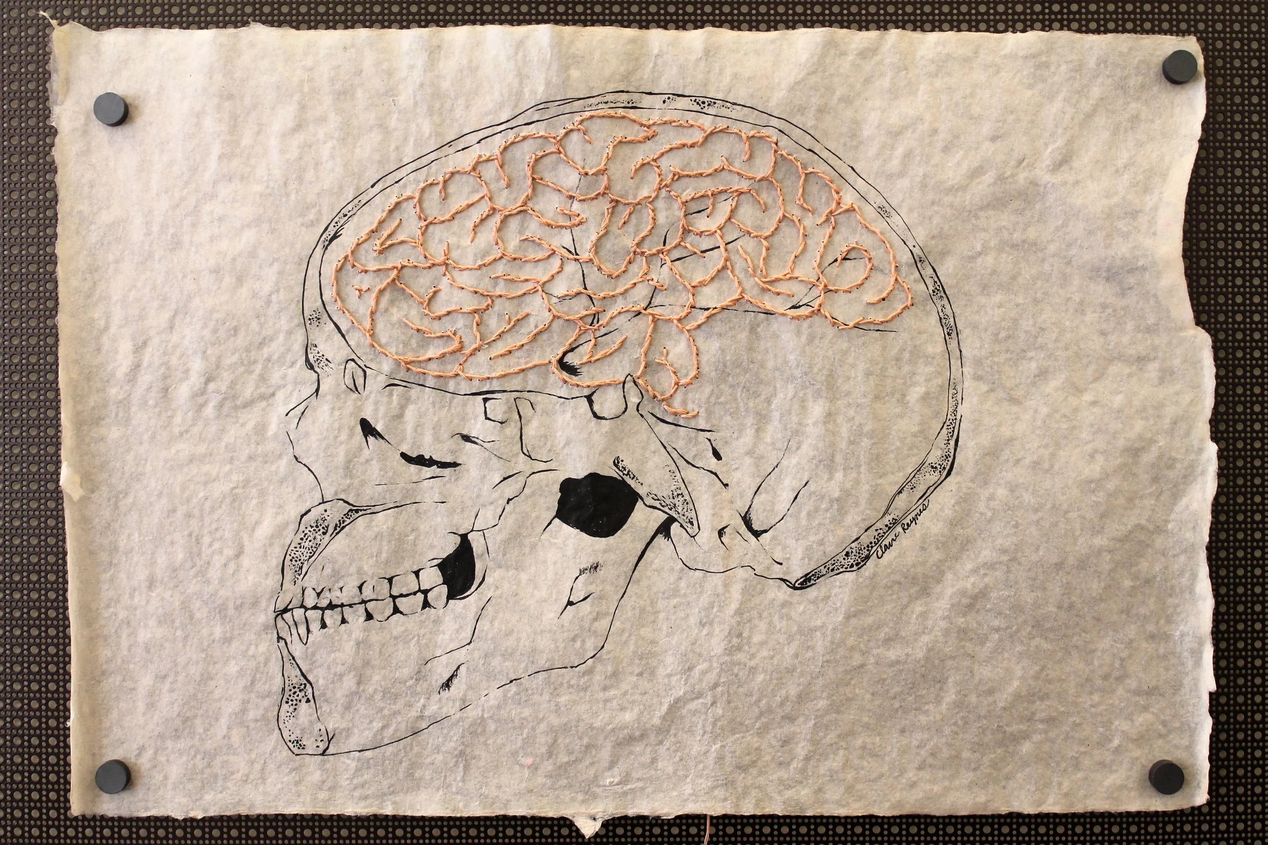 skull and brain