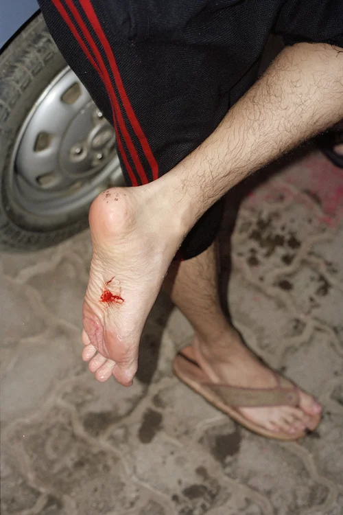 foot_small.jpg