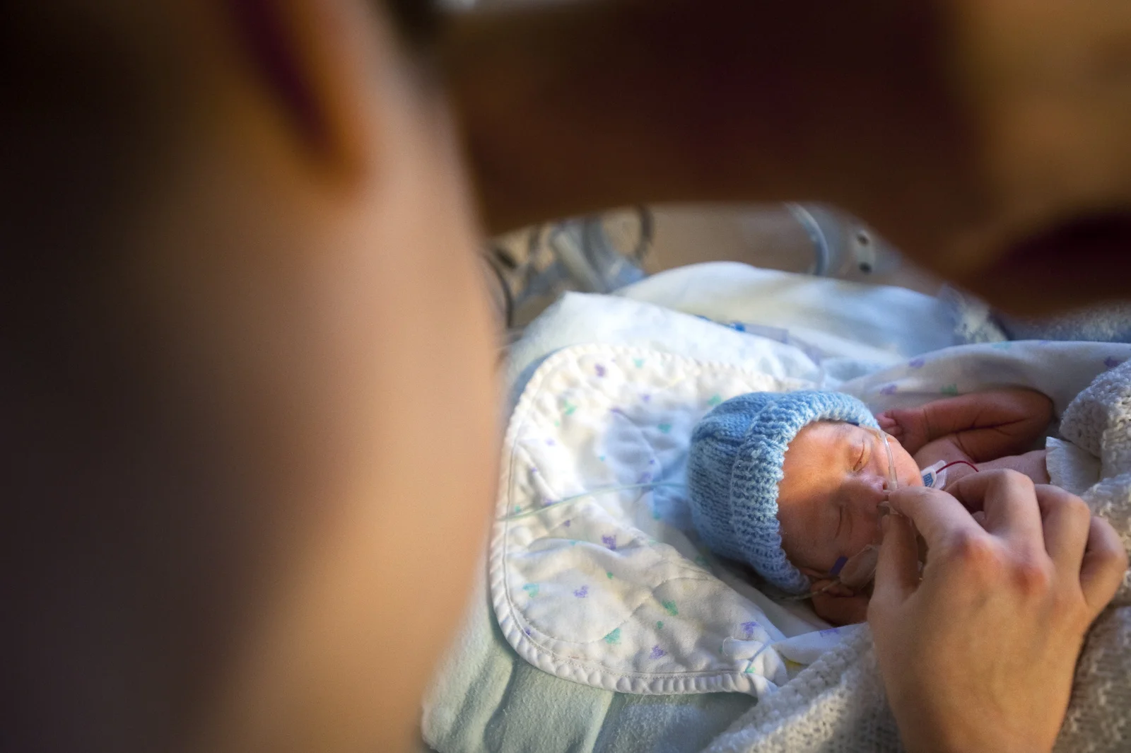 Mum adjusting oxygen tubes to Felix's nose