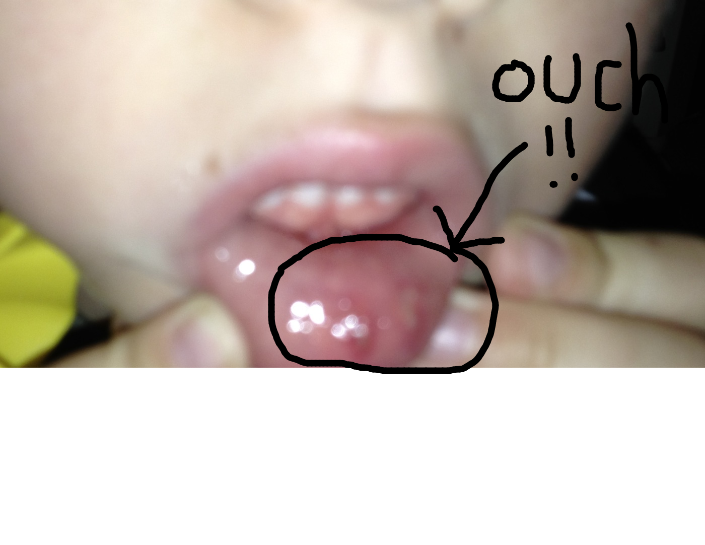 w lip.png