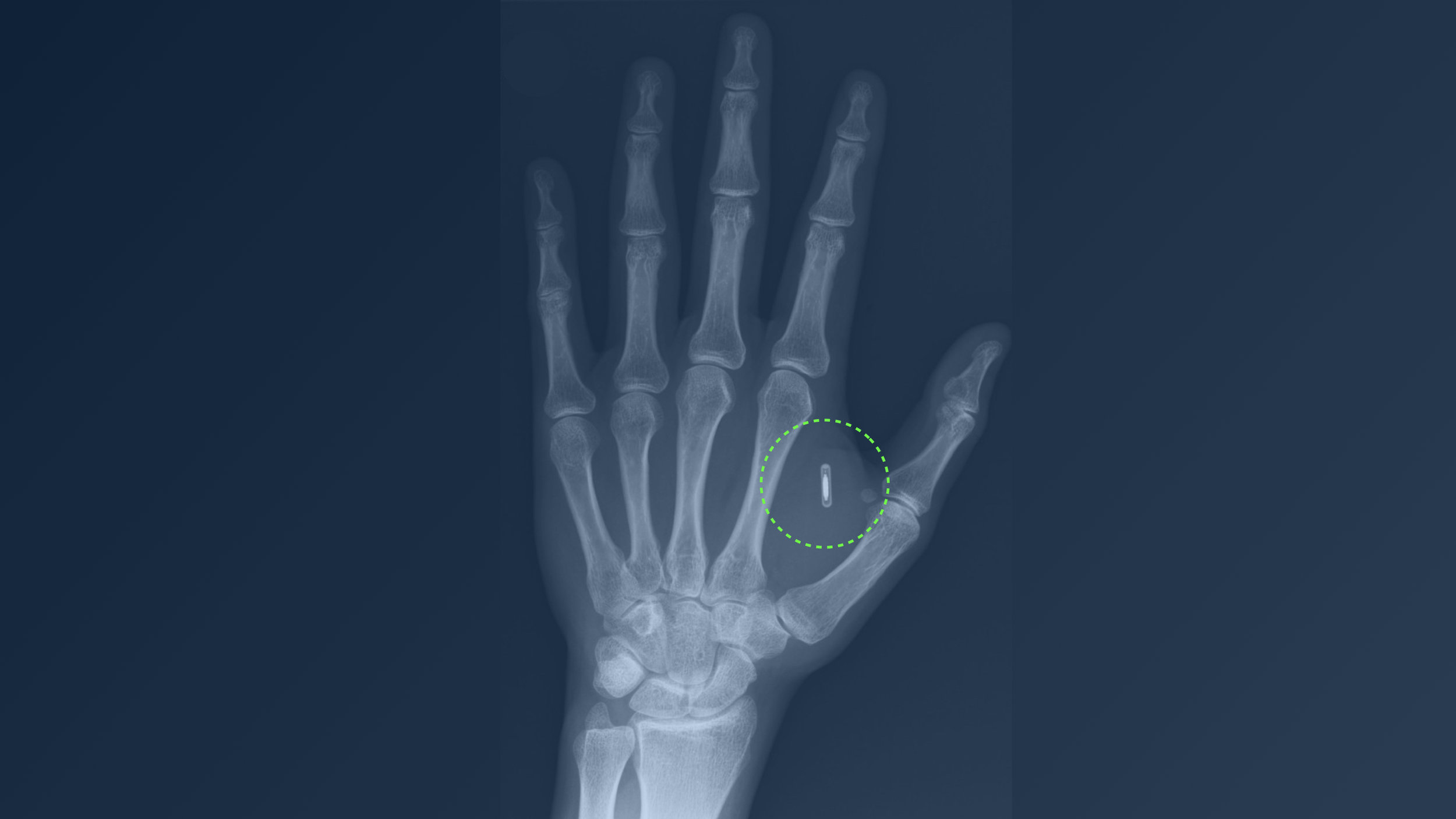 hand xrays.002.jpeg