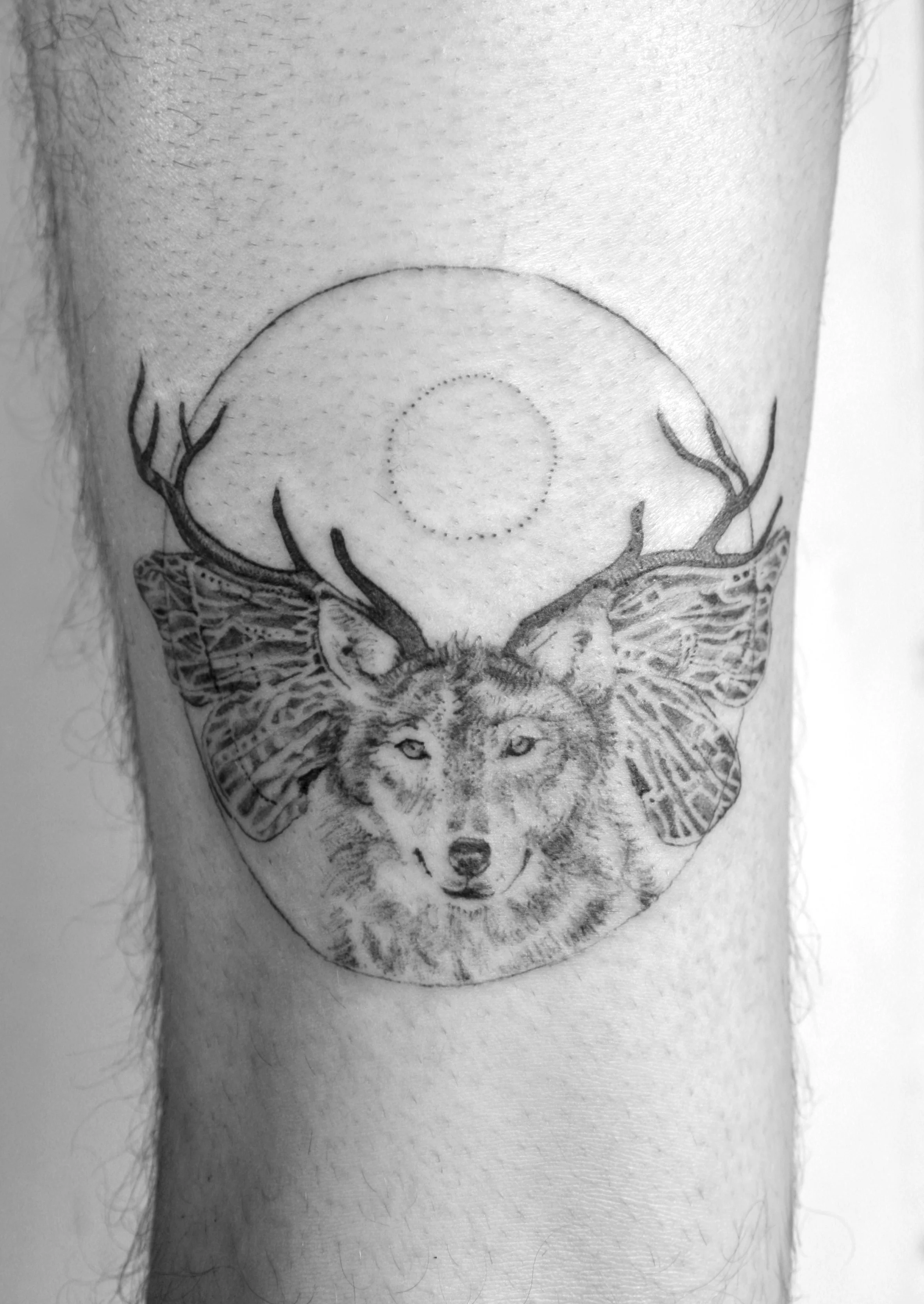 bryan leg.jpg
