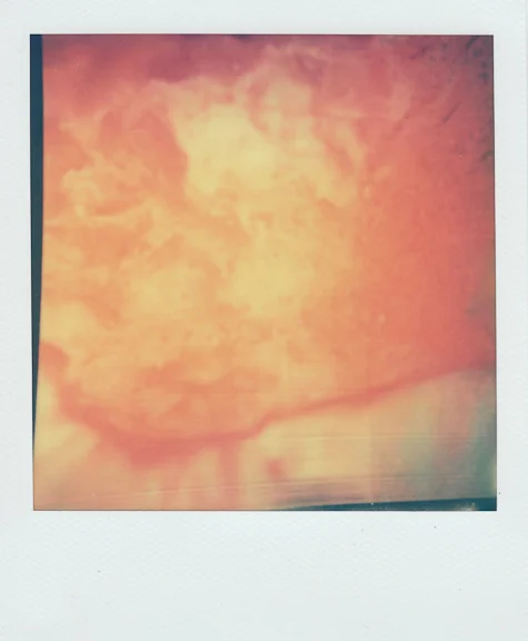 bruise-19 copy.jpg