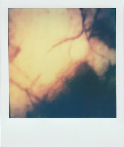 bruise-4 copy.jpg