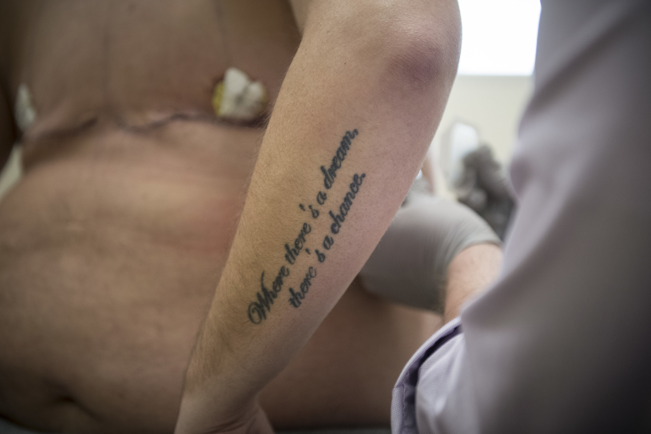  A tattoo on Beau’s arm reads "where there's a dream, there's a chance." 