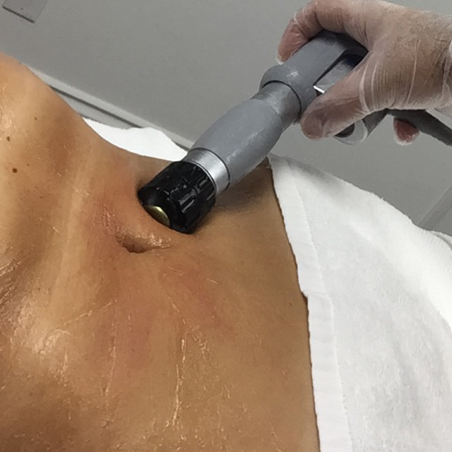 SkinWave abdominal treatment