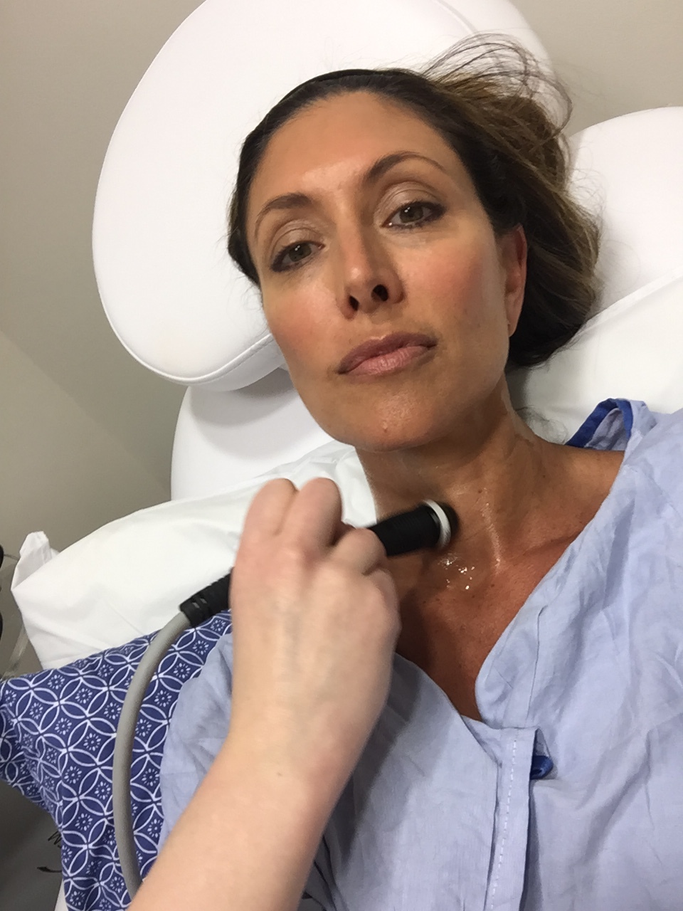 I had instant results with the ThermiSmooth treatment on my neck and around my eyes. And, it was painless!