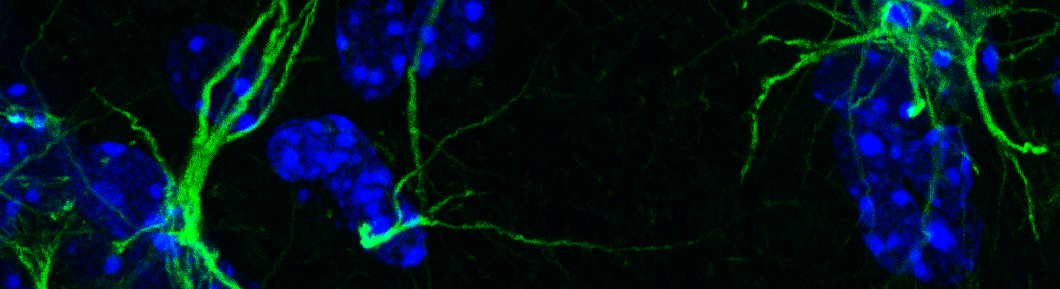 Astrocytes expressing the Netrin-1 receptor UNC-5 (in green) appear to embrace neuronal cell bodies (in blue). Molecular and Cellular Microscopy Platform, Douglas Hospital Research Centre, 2017. Photo by Daniel Hoops.