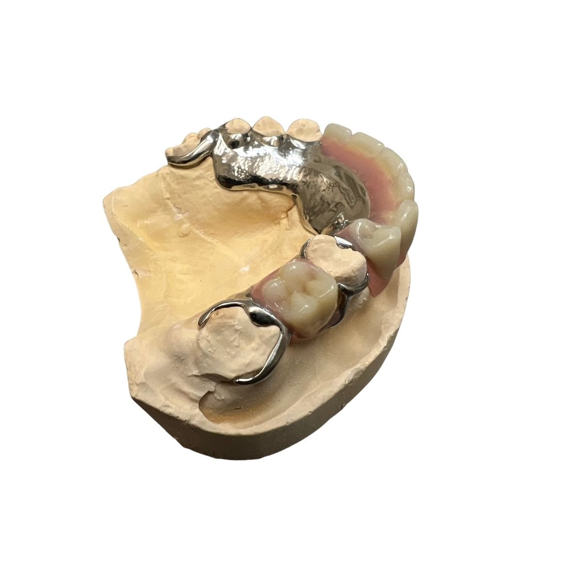 Chrome Partial Dentures, What are the Benefits and Costs? — All Smiles