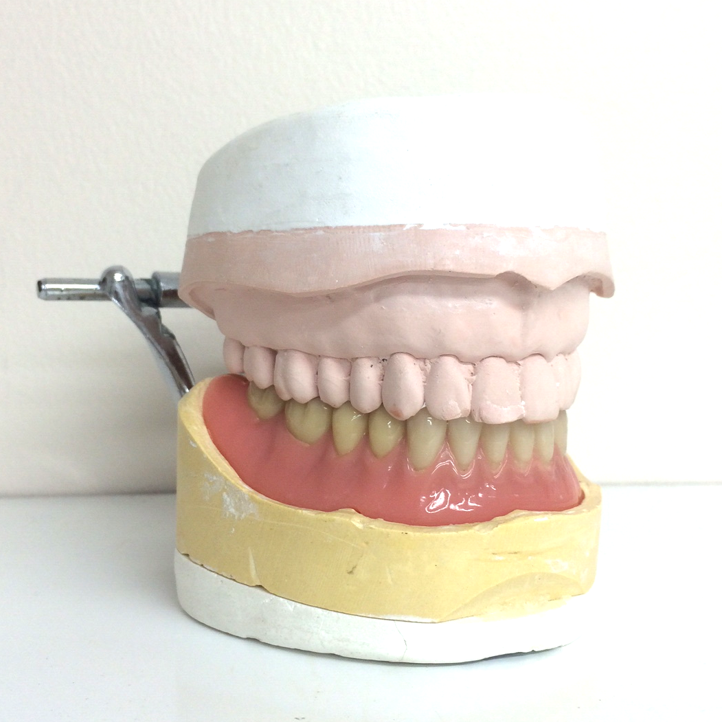 lower denture