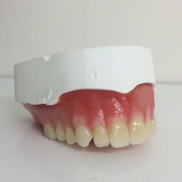 denture