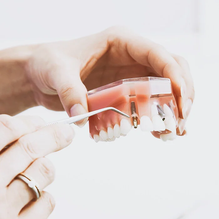 implant denture.jpg