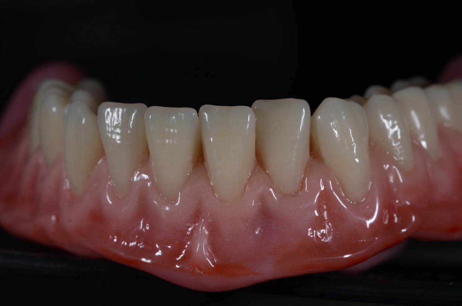 Denture Clinic Near Me — All Smiles Denture Clinic