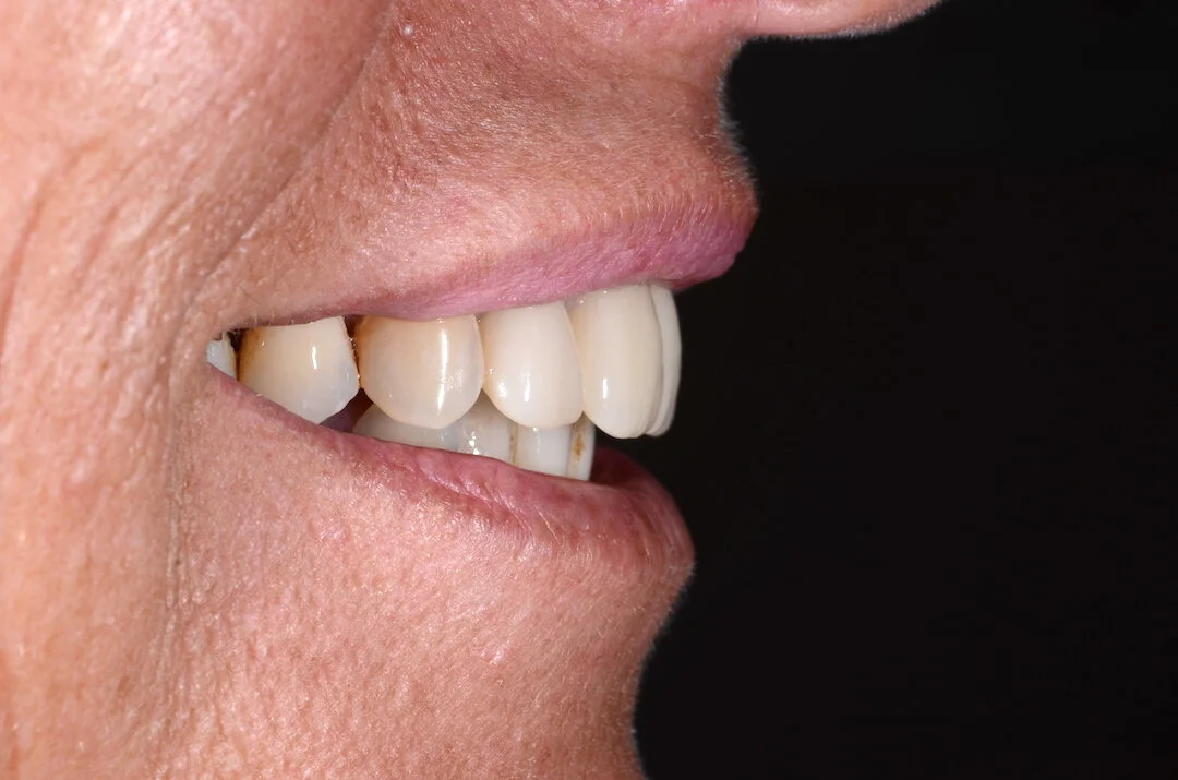 Denture Clinic Sunshine Coast Denture Clinic Near Me