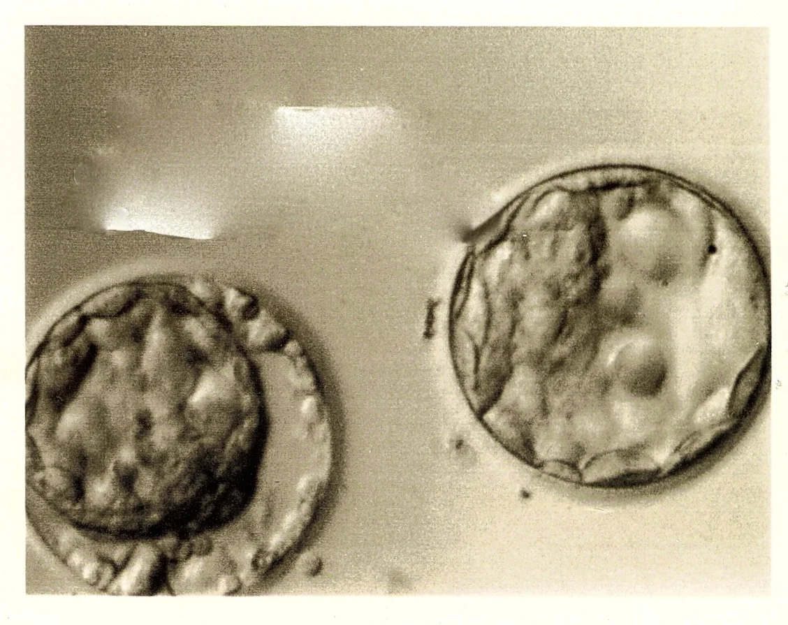 Our first two embryos many moons ago.........