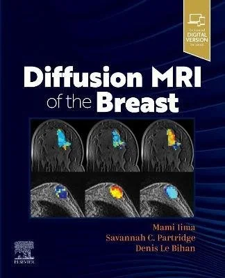 mri of the breast.jpeg