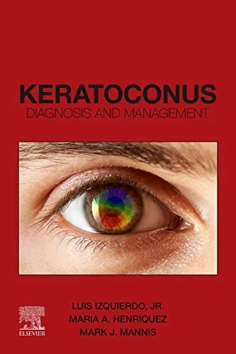 keratoconus.jpeg