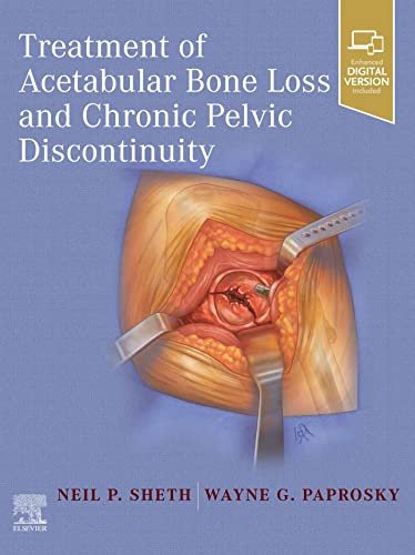 acetabular bone loss.jpeg