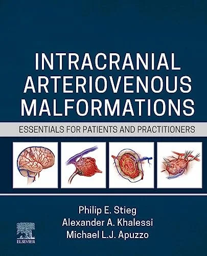 intracranial.jpeg