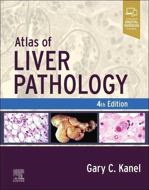 atlas of liver.jpeg