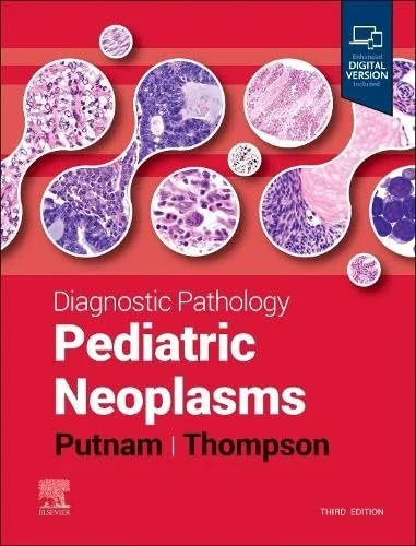 Pediatric Neoplasms.jpeg