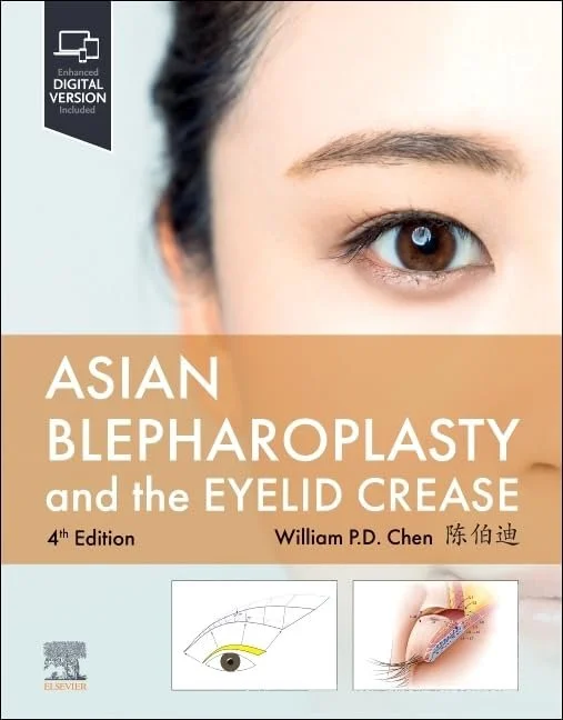 Asian Blepharoplasty.jpeg