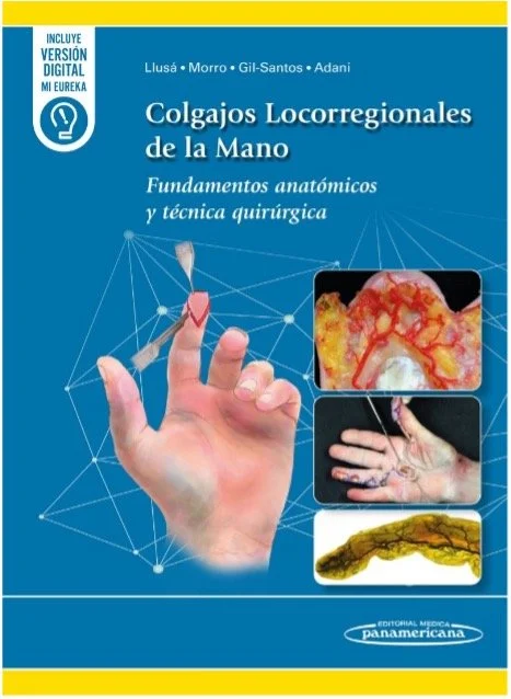 Colgajos Locorregionales de la Mano