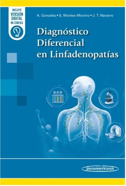 Diagnóstico Diferencial en Linfadenopatías