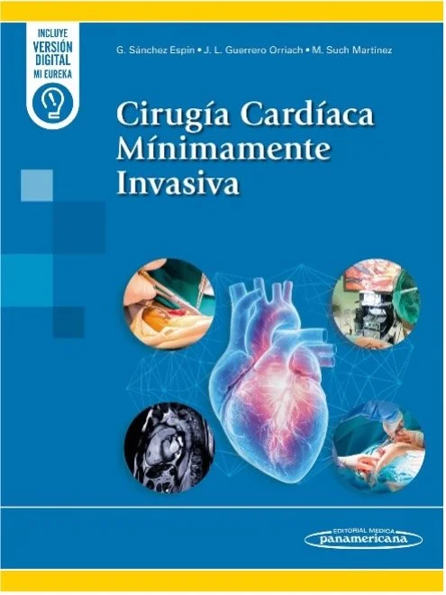 Cirugía Cardiaca Mínimamente Invasiva