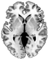 brain.jpg