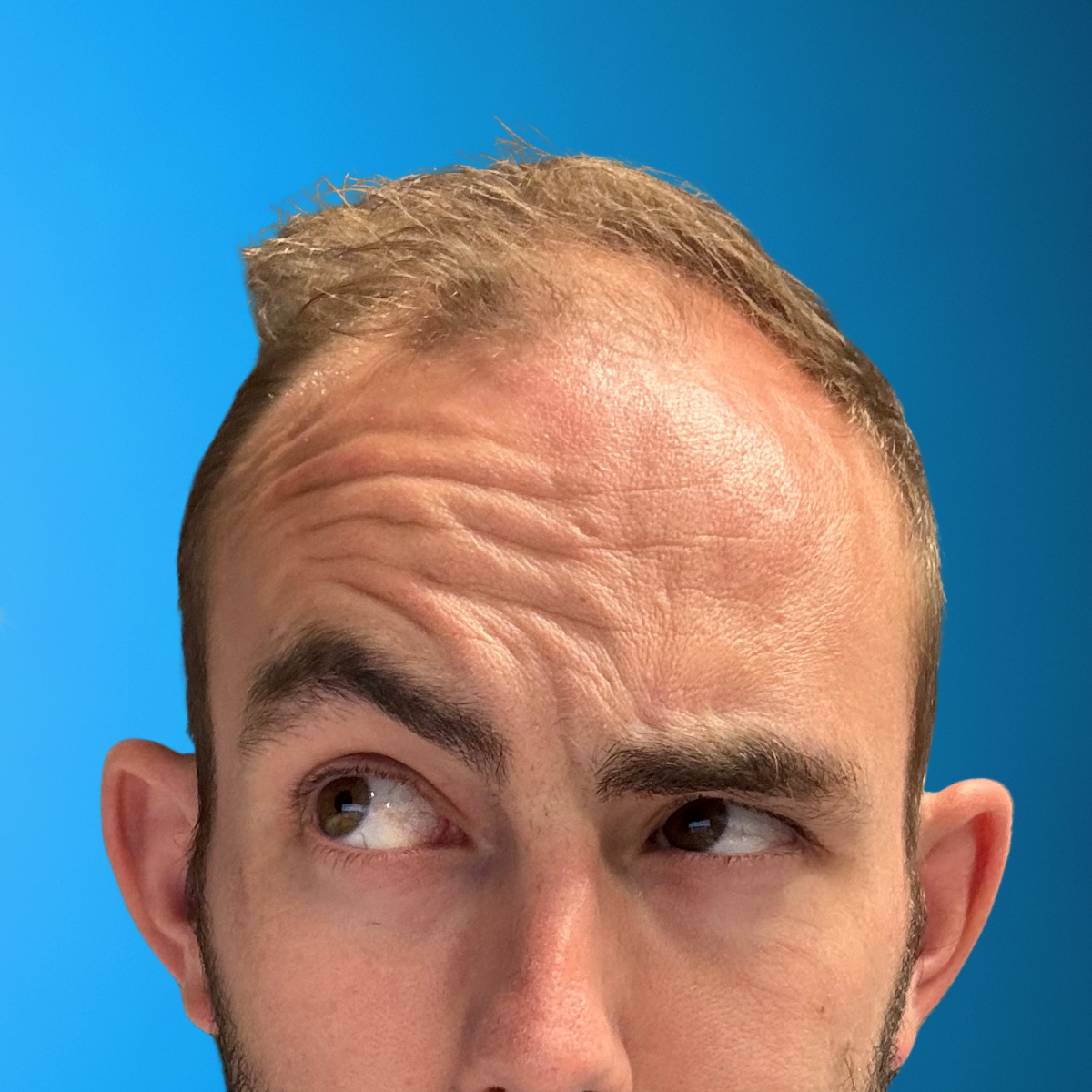 Cal Halbert - 100 Impressions In One Hour