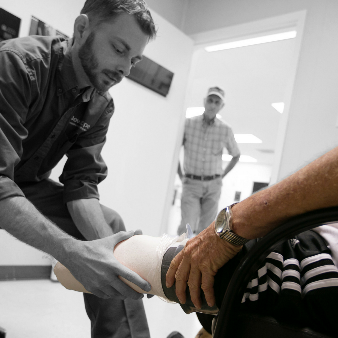 How To Properly Care For A Residual Limb