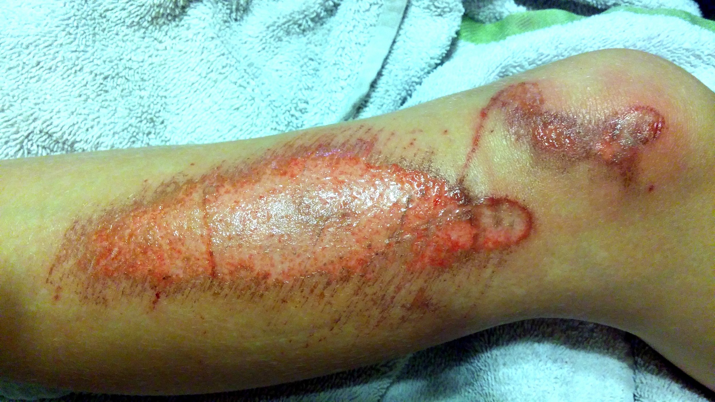 Max's scrape.jpg