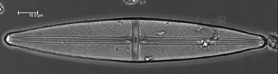A diatom of the genus Navicula collected in Peru. 