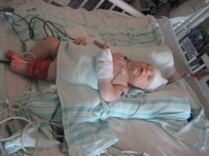 Joe in the PICU, day 2. 